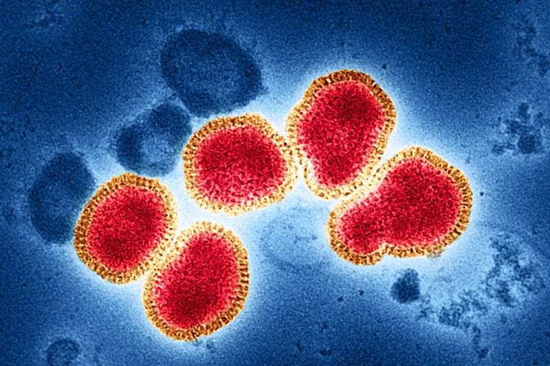 Colorized transmission electron micrograph showing multiple influenza A virus particles with red cores and yellow spiky envelopes against a blue background